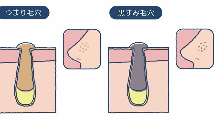 得物钱包余额提现攻略：方法与技巧